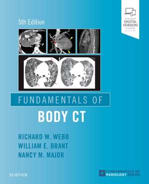 Fundamentals of Body CT de W Richard Webb