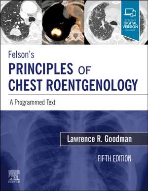 Felson’s Principles of Chest Roentgenology, A Programmed Text alte