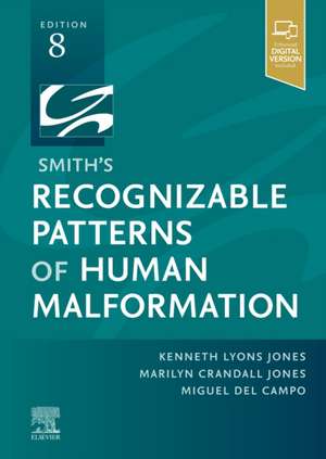 Smith's Recognizable Patterns of Human Malformation de Kenneth Lyons Jones