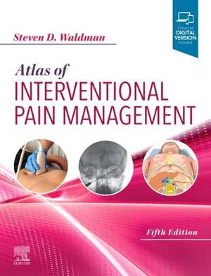 Atlas of Interventional Pain Management: Waldman Atlas de terapia durerii de Steven D. Waldman