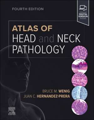 Atlas of Head and Neck Pathology de Bruce M. Wenig