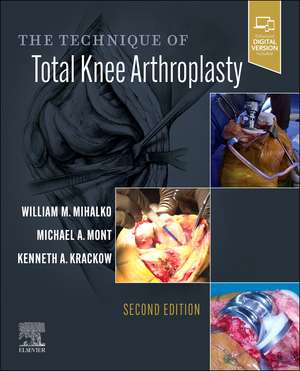 The Technique of Total Knee Arthroplasty de William M. Mihalko