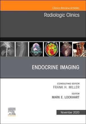 Endocrine Imaging , An Issue of Radiologic Clinics of North America de Mark E. Lockhart