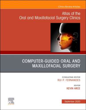 Guided Oral and Maxillofacial Surgery An Issue of Atlas of the Oral & Maxillofacial Surgery Clinics de Kevin Arce