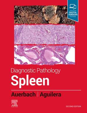 Diagnostic Pathology: Spleen de Aaron Auerbach