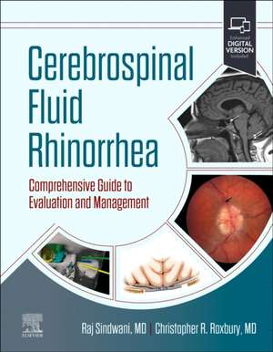 Cerebrospinal Fluid Rhinorrhea: Comprehensive Guide to Evaluation and Management de Raj Sindwani