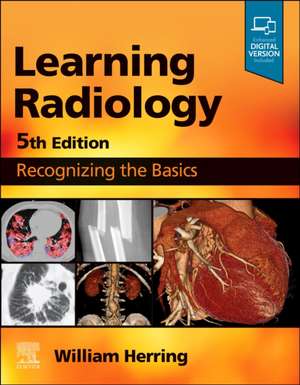 Learning Radiology: Recognizing the Basics de William Herring