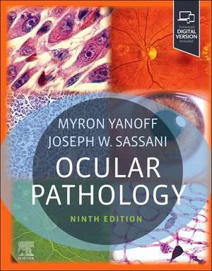 Ocular Pathology de Myron Yanoff