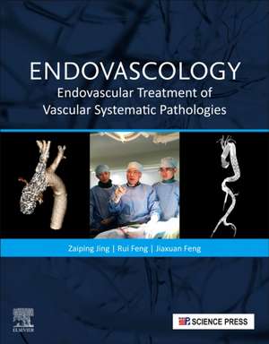 Endovascology: Endovascular Treatment of Vascular Systematic Pathologies de Zaiping Jing