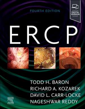 ERCP de Todd H. Baron