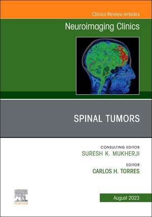 Spinal Tumors, An Issue of Neuroimaging Clinics of North America de Carlos H. Torres