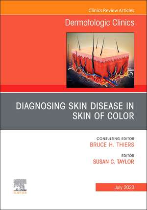 Diagnosing Skin Disease in Skin of Color, An Issue of Dermatologic Clinics de Susan C. Taylor