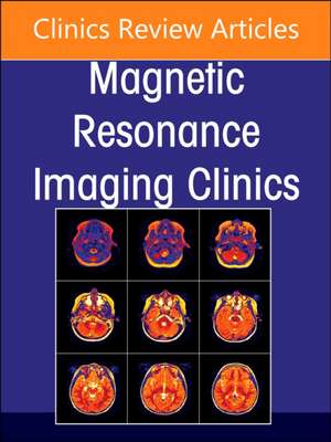 MR Imaging of the Adnexa, An Issue of Magnetic Resonance Imaging Clinics of North America de Erica B. Stein