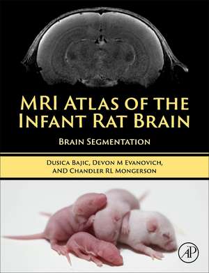 MRI Atlas of the Infant Rat Brain: Brain Segmentation de Dusica Bajic