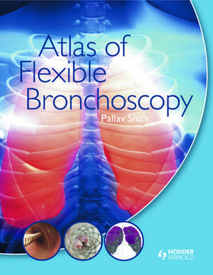 Atlas of Flexible Bronchoscopy de Pallav Shah