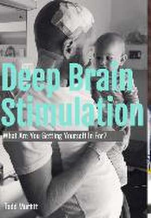 Deep Brain Stimulation - What are you getting yourself in for? de Todd Murfitt