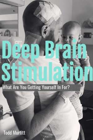 Deep Brain Stimulation - What are you getting yourself in for? de Todd Murfitt