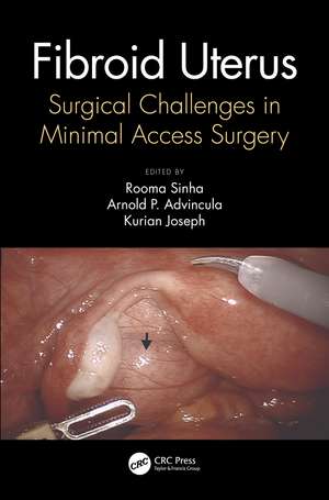 Fibroid Uterus: Surgical Challenges in Minimal Access Surgery de Rooma Sinha