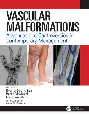 Vascular Malformations: Advances and Controversies in Contemporary Management de Byung Boong Lee