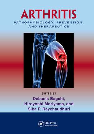 Arthritis: Pathophysiology, Prevention, and Therapeutics de Debasis Bagchi