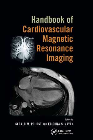 Handbook of Cardiovascular Magnetic Resonance Imaging de Gerald M. Pohost