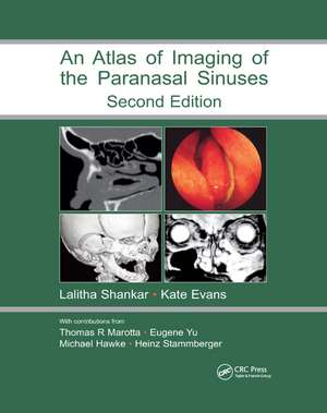 Atlas of Imaging of the Paranasal Sinuses, Second Edition de Lalitha Shankar