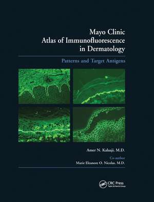 Mayo Clinic Atlas of Immunofluorescence in Dermatology: Patterns and Target Antigens de Amer N. Kalaaji