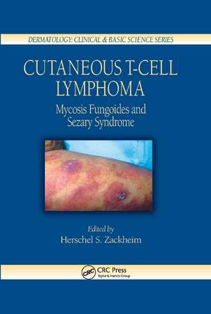 Cutaneous T-Cell Lymphoma: Mycosis Fungoides and Sezary Syndrome de Herschel S. Zackheim