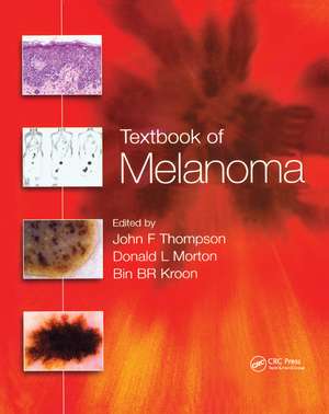 Textbook of Melanoma: Pathology, Diagnosis and Management de John F. Thompson