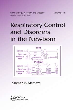 Respiratory Control and Disorders in the Newborn de Oomen P. Mathew