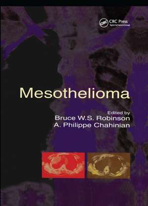 Mesothelioma de Bruce W S Robinson