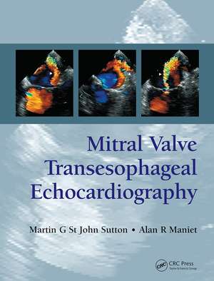 Mitral Valve Transesophageal Echocardiography de Martin G. St. John Sutton