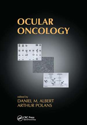 Ocular Oncology de Daniel M. Albert