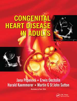 Congenital Heart Disease in Adults de Jana Popelova