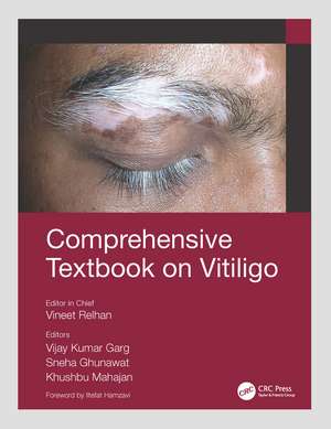 Comprehensive Textbook on Vitiligo de Vineet Relhan