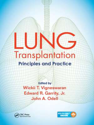 Lung Transplantation: Principles and Practice de Wickii Vigneswaran