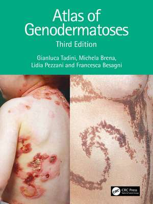 Atlas of Genodermatoses de Gianluca Tadini