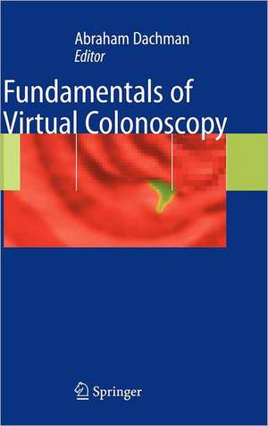 Fundamentals of Virtual Colonoscopy de Abraham H. Dachman