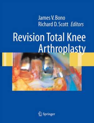 Revision Total Knee Arthroplasty de C.S. Ranawat