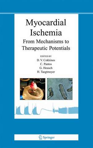 Myocardial Ischemia: From Mechanisms to Therapeutic Potentials de Dennis V. P. Cokkinos