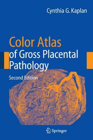 Color Atlas of Gross Placental Pathology de Cynthia G. Kaplan