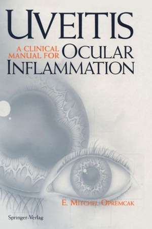 Uveitis: A Clinical Manual for Ocular Inflammation de K. Kachelein