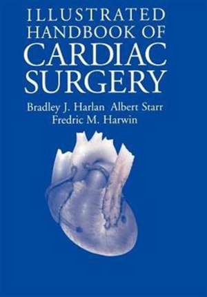 Illustrated Handbook of Cardiac Surgery de Bradley J. Harlan