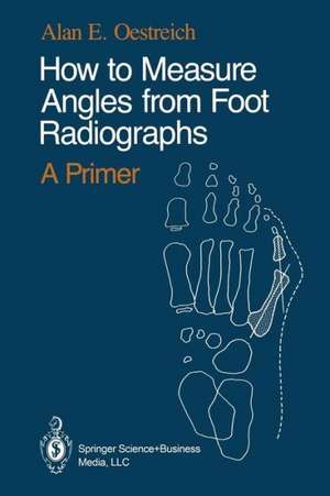 How to Measure Angles from Foot Radiographs: A Primer de Alan E. Oestreich