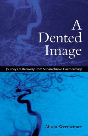 A Dented Image: Journeys of Recovery from Subarachnoid Haemorrhage de Alison Wertheimer