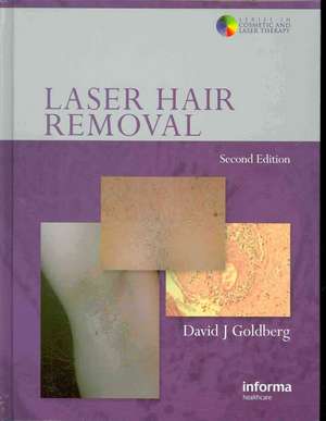 Laser Hair Removal de David J. Goldberg