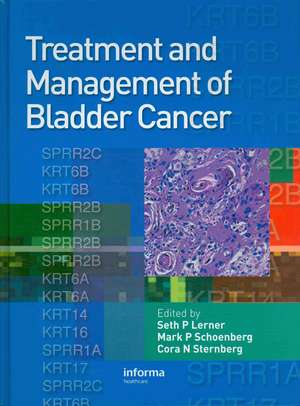 Treatment and Management of Bladder Cancer de Seth P. Lerner