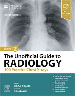 The Unofficial Guide to Radiology: 100 Practice Chest X-rays de Ali B.A.K. Al-Hadithi