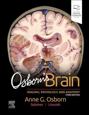 Osborn's Brain de Anne G. Osborn