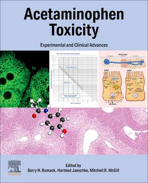 Acetaminophen Toxicity: Experimental and Clinical Advances de Barry Rumack